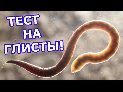 Видео: Анализ на изпражненията за яйца от червеи. Как правилно да се подготвим и да преминем анализа?