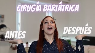 Como cambia la vida antes y después de la Cirugia Bariatrica