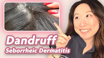 All about Dandruff & Seborrheic Dermatitis | Dermatologist Explains