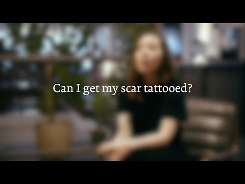 Can I get my scar tattooed?