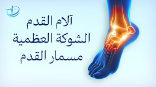 شوكة الكعب العظمية أسبابها وعلاجها النتيجة من اول تمرين|الكعب|مسمار|الم القدم|التهاب اللفافة الاخمصي