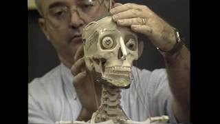 Celebrity Historical PSAs - Bionic Skeleton Net Worth