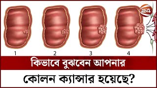 কিভাবে বুঝবেন আপনার কোলন ক্যান্সার হয়েছে? | Colon Cancer Symptoms | Channel 24