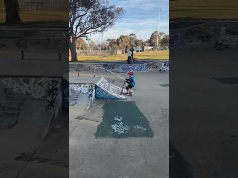 I foot hip