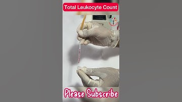 TLC ll Totaal leukocytenaantal Praktisch ll WBC-aantal ll #pathogenese ll #barman_sir