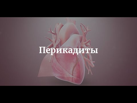 Перикардиты - Этиология,