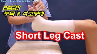 Short Leg Cast