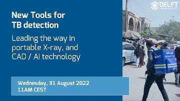 Delft Imaging Webinar: New Tools for TB Detection