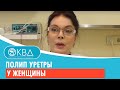 😲 Полип уретры у женщины. Клинический случай №573