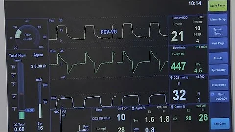 4 Republicans defy Speaker Johnson to force House vote on extending ACA subsidies