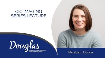 Finding similarity across neural diversity: an empirical evaluation of functional alignment.