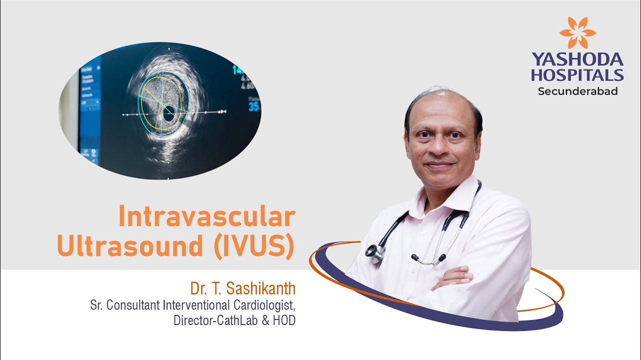 Intravascular Ultrasound (IVUS) | Yashoda Hospitals Hyderabad - YouTube