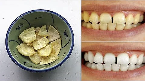 牙齿发黄不要花钱去洗牙！教你一个土方法，让黄牙瞬间变白，完全没有副作用！ - 天天要闻