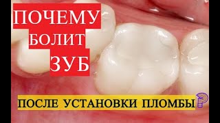 Почему болит зуб после установки пломбы? Просто, понятно и доступно.