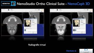 NemoStudio Ortho Clinical Suite