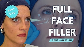 Elevate Your Injecting Skills: CLAIRE - Full Face Filler Case Study Pt 1 ft. GEM by Harley Academy 🚀