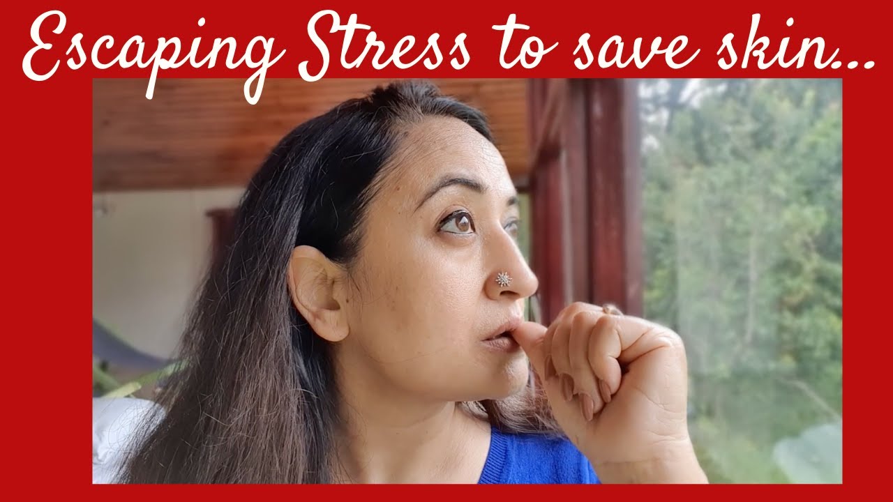 De-Stress Skin by Stopping Stress Internally+Skincare Ingredients to Help Calm Skin | CJOY Series 1