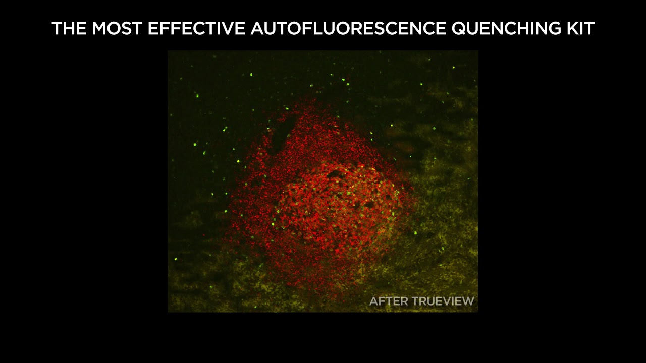 Quench Rbc Autofluorescence TrueVIEW™ Autofluorescence Quenching Kit – See True Signal - YouTube