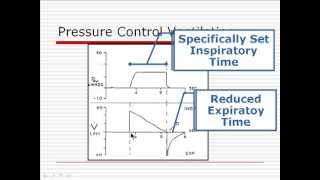 Mechanical Ventilation  Section 3
