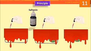 Spore Stain: Schaeffer–Fulton Method- Lab 11