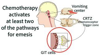 Antiemetics for Chemotherapy and GIT Origins