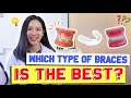 Types of Braces COMPARED & EXPLAINED! | #BraceYourself!🦷