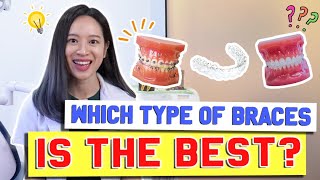 Types of Braces COMPARED & EXPLAINED! | #BraceYourself!