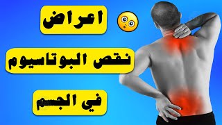 اعراض نقص البوتاسيوم في الجسم