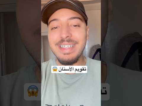 تقويم الأسنان