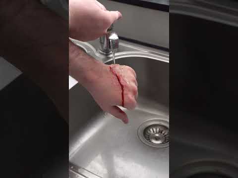 What Does Ice Mean In First Aid