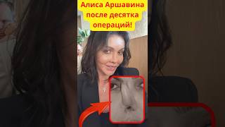 Болезнь уничтожила её нос… но врачи сотворили чудо!