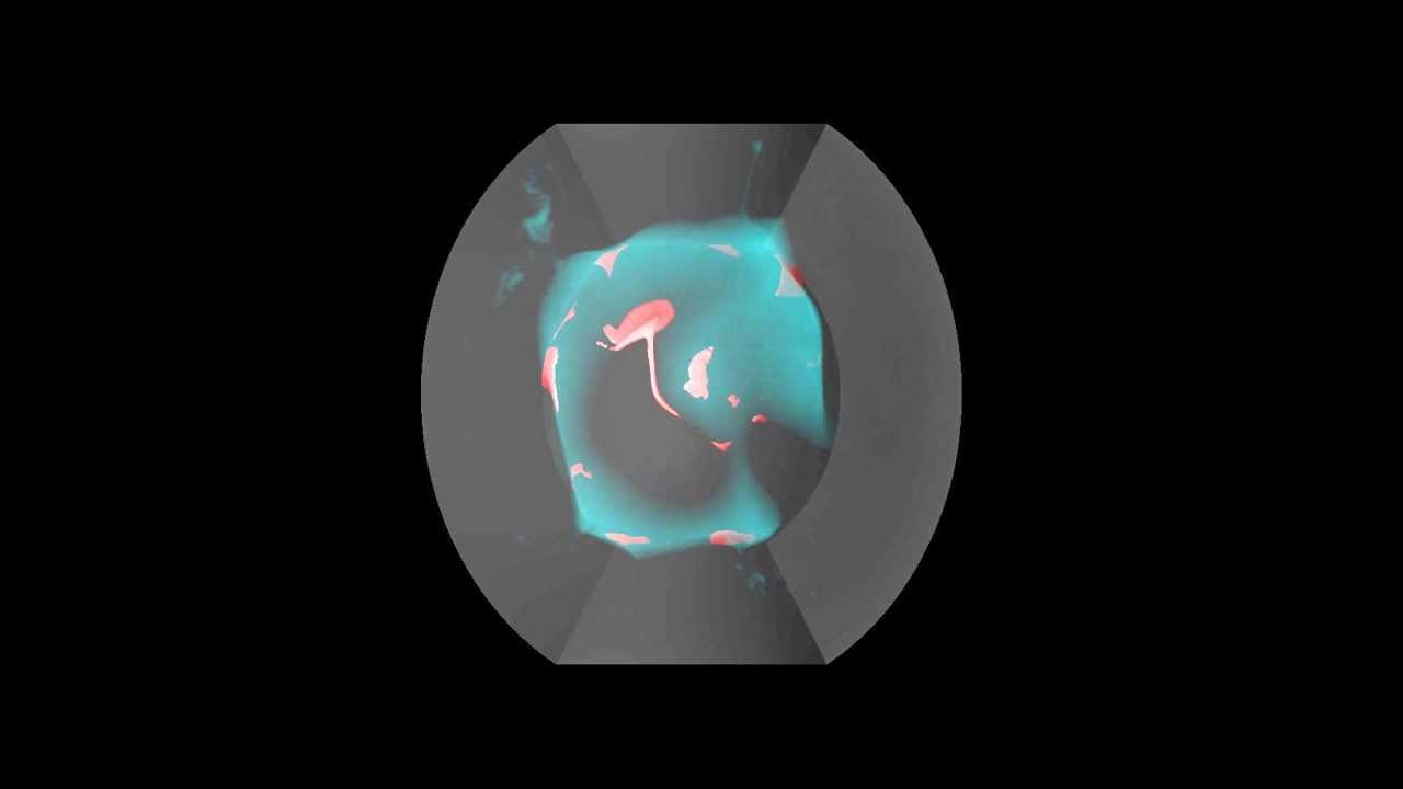 Morphology and dynamics of ultra-low velocity zones