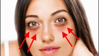 Wasfa 3Ajiba Lilhalat Sawda2 L3Ayn