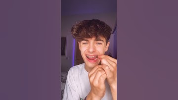 Kyle Thomas 💙 changing my braces to BLUE! 😱💙 should i keep them? #kylethomas #shorts