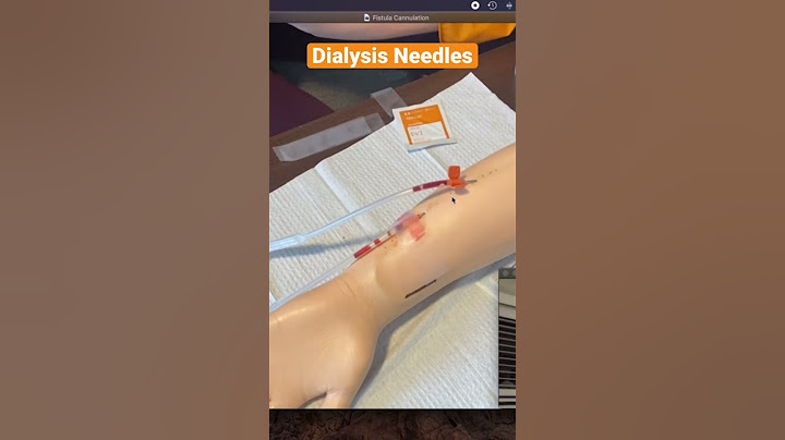 Mastering Dialysis - Learn How To Insert Needles For AV Fistula!