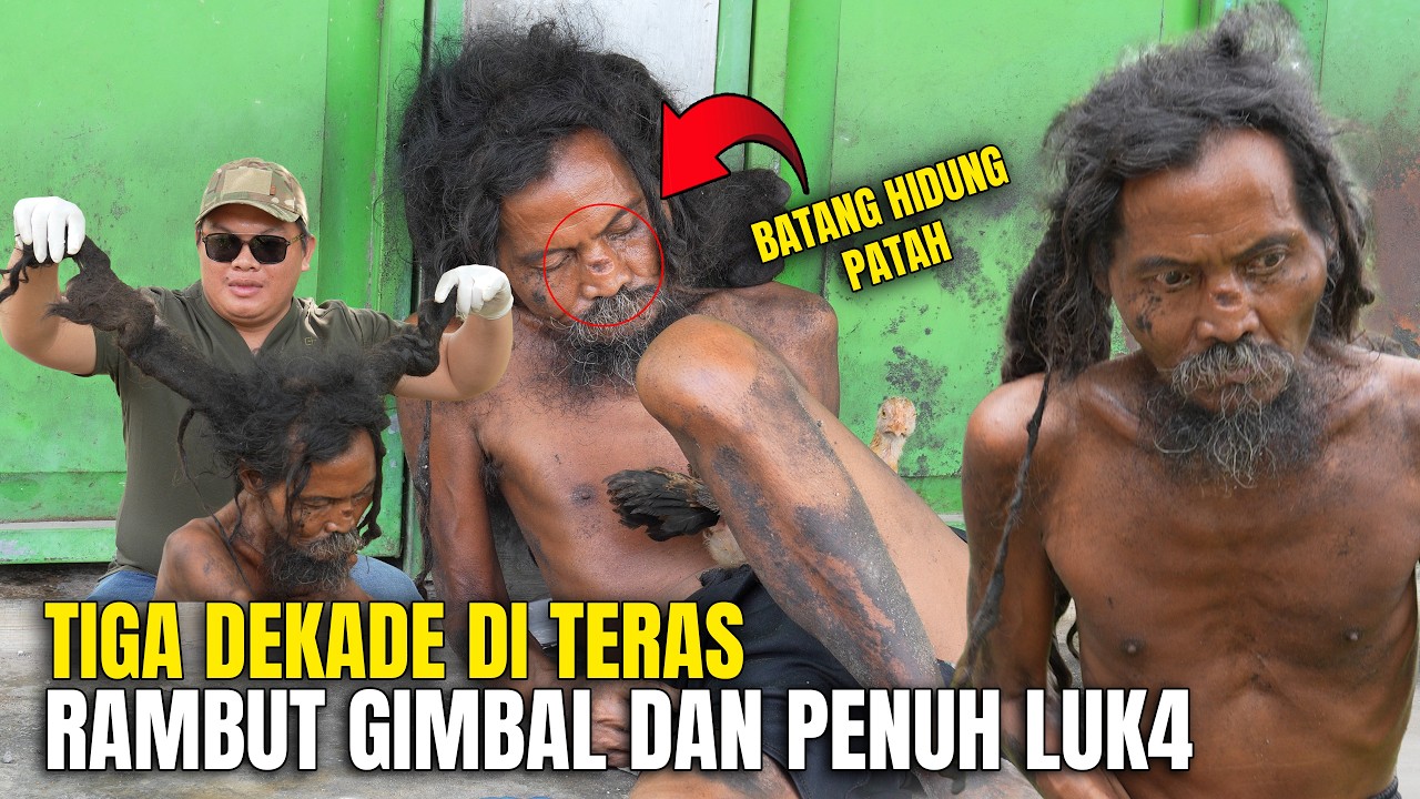 Hidung Pat4h & Rambut Gimbal, 30 Tahun di Teras rumah warga