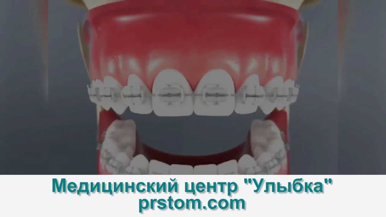 Улыбка давлеканово. Улыбка давлеканово