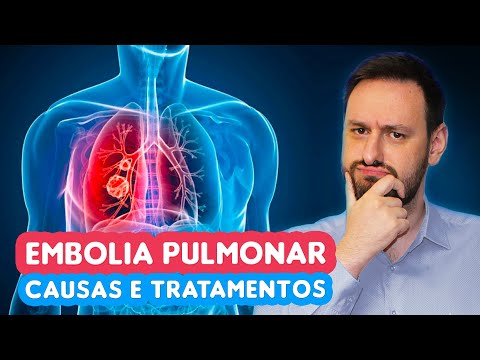 Vídeo: Como é uma embolia pulmonar?