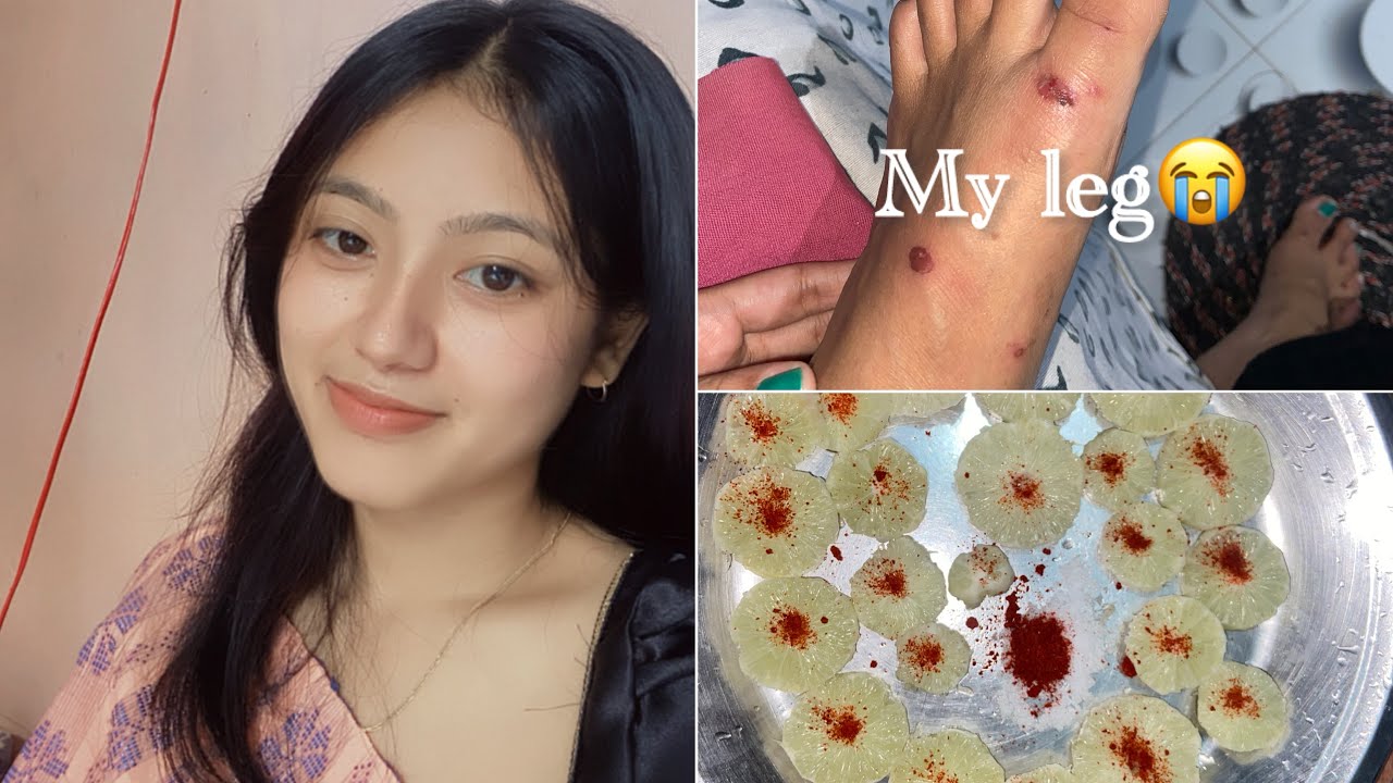 Went to village🌷|| what happened to my leg 🥹|| vlog ||@ma.shiaaa 