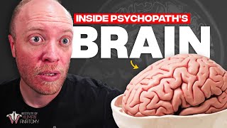 Inside the Brain of a Psychopath