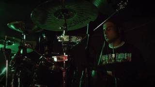 Download lagu IM Drunk - T.H.C. (Tumoral Hepatic Compsumation)