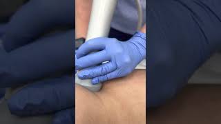 Zimmer Shockwave Therapy at InjectAbility