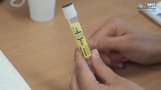 Urine test for Gonorrhoea and Chlamydia