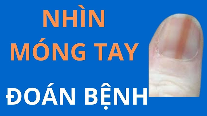 Móng tay bị trắng đục là bệnh gì năm 2024