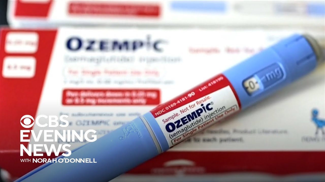 does taking tirzepatide cause hair loss Hairloss directly from Tirzepatide? : r/tirzepatidecompound