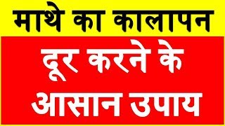 माथे का कालापन कैसे करे दूर Remove Forehead dark spots Get Rid sun tan form Forehead Home Remedies screenshot 2