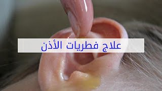 علاج فطريات الأذن