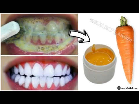 Teeth whitening in just 2 minutes - how to whiten teeth at home? 100% effective