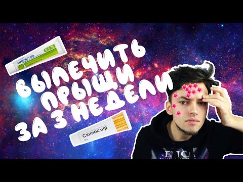 ВЫЛЕЧИТЬ ПРЫЩИ ЗА ТРИ НЕДЕЛИ :О МОЙ ОПЫТ: ДИФФЕРИН И СКИНОРЕН/СКИНОКЛИР