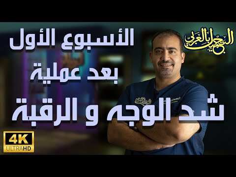 اول اسبوع بعد عملية شد الوجة و الرقبة شد الوجه